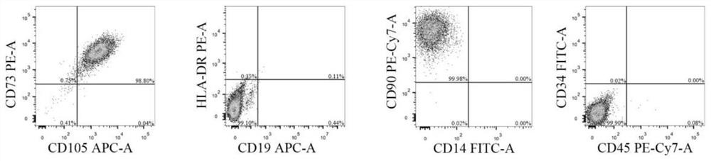 Method for treating cerebral ischemia-reperfusion injury by using dental pulp stem cell exosome