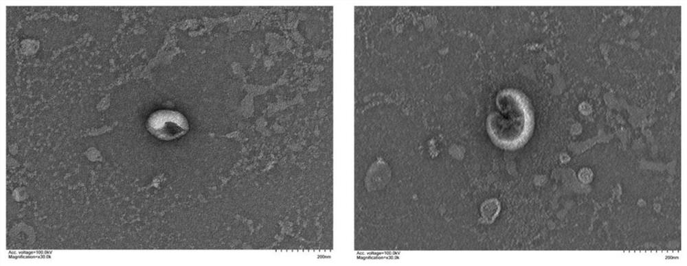 Method for treating cerebral ischemia-reperfusion injury by using dental pulp stem cell exosome