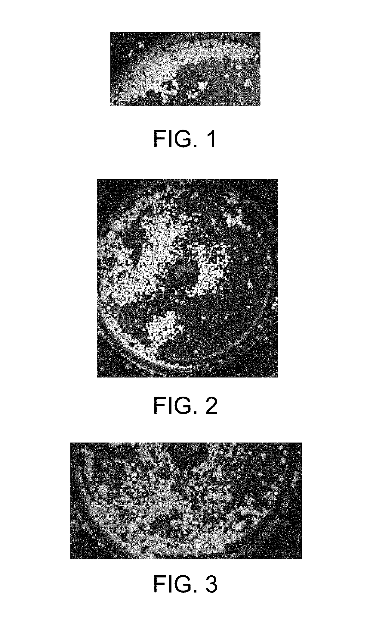 Method for preparing degradable drug-loaded microsphere for embolization, and product obtained therefrom