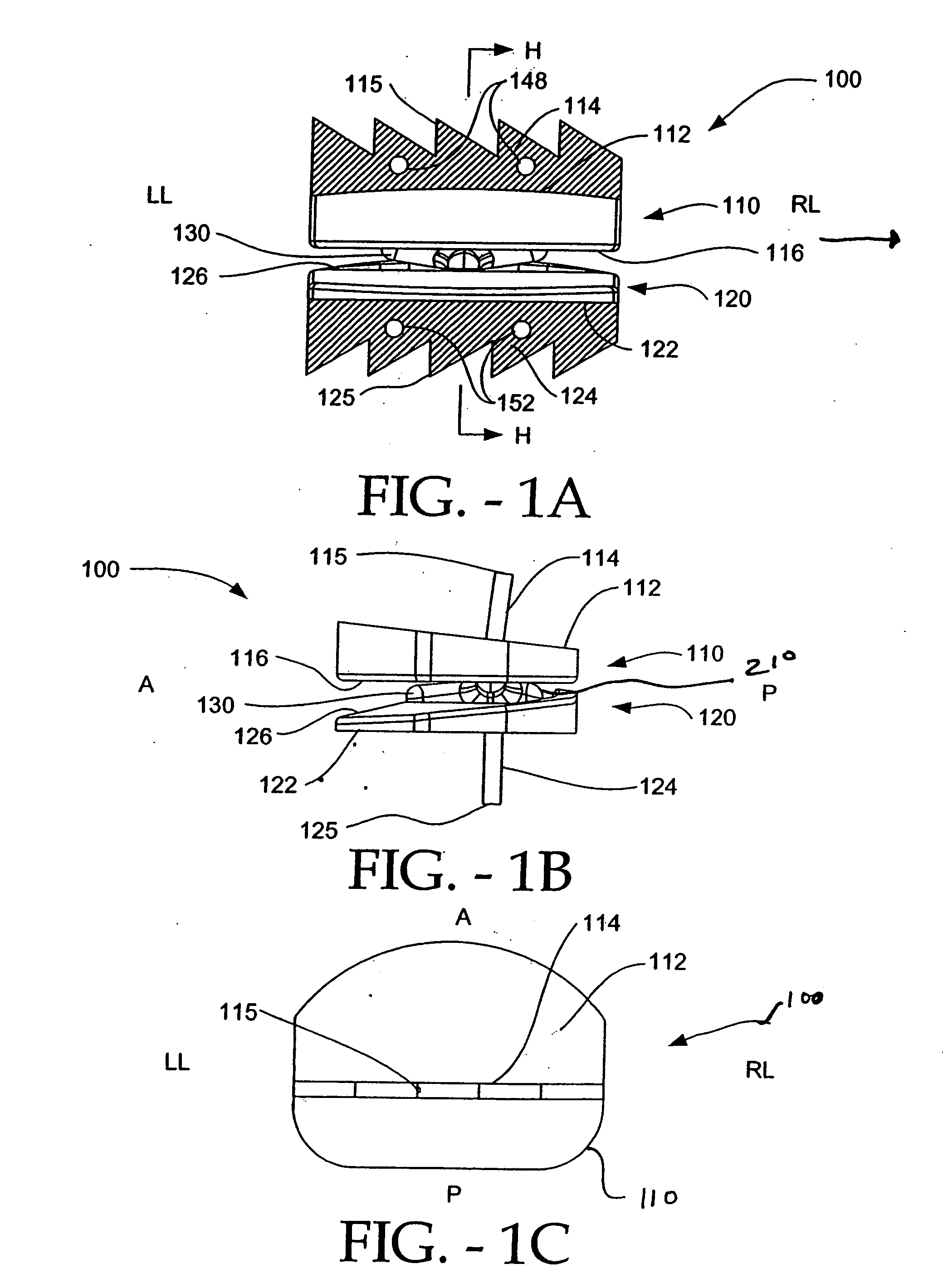 Method of laterally inserting an artificial vertebral disk replacement implant with crossbar spacer