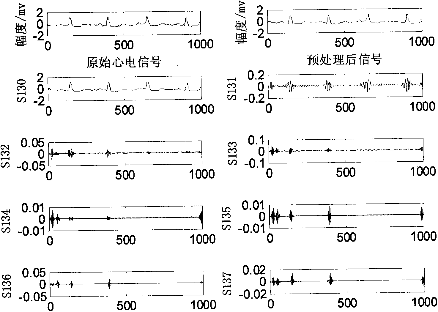 ECG signal classifying method based on wavelet packet and approximate entropy