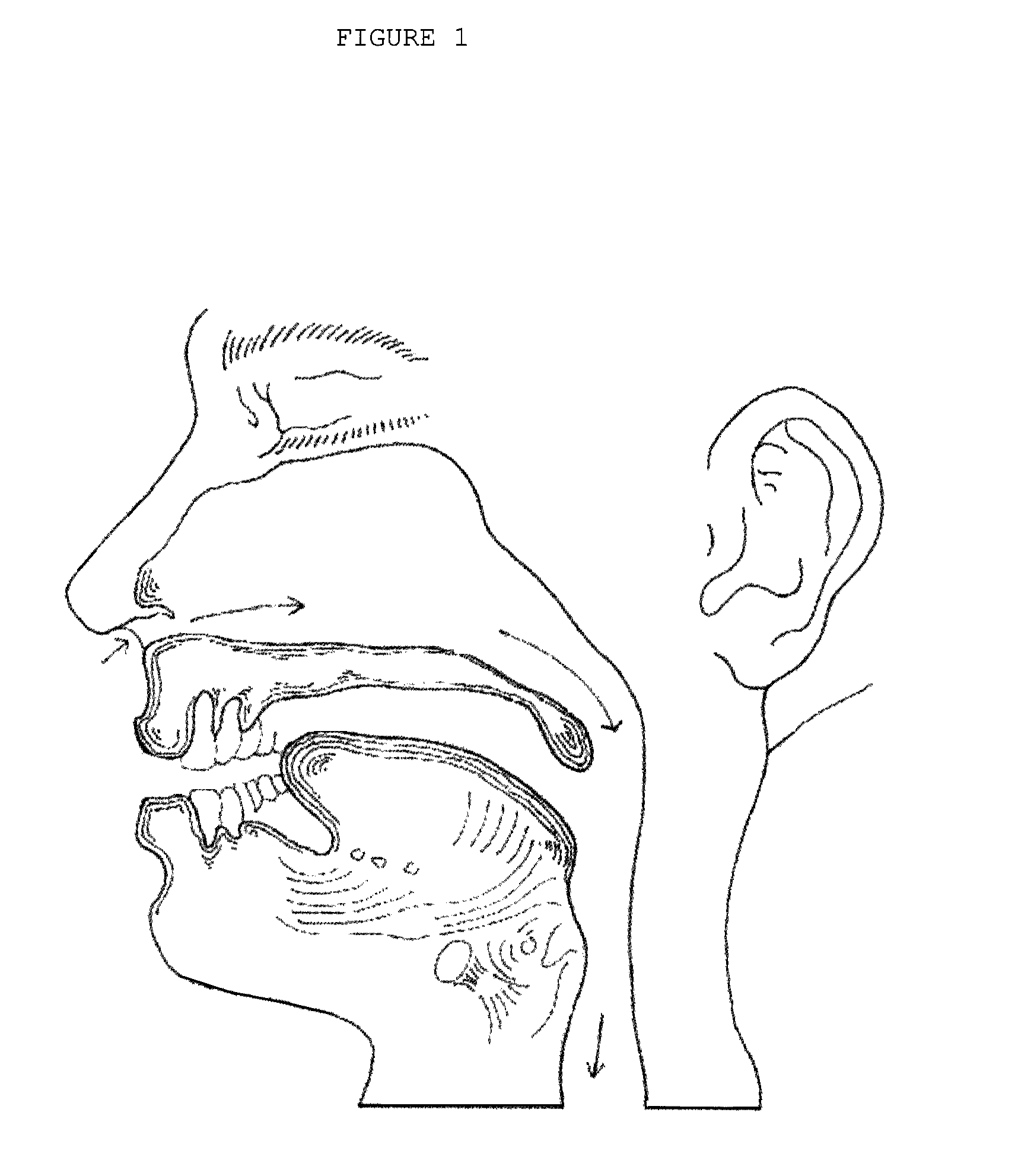 Integrated oral appliance for sleep-disordered breathing