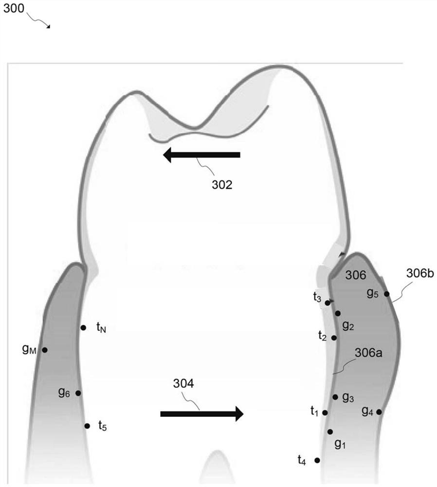 Virtual modeling of gingival adaptation to step-by-step orthodontic treatment and related appliance manufacturing method