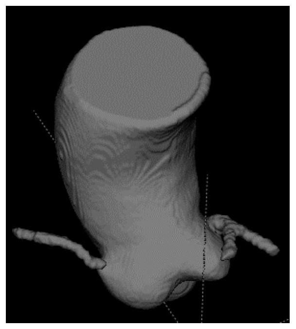 Cardiac artery blood vessel segmentation method and device, equipment and medium