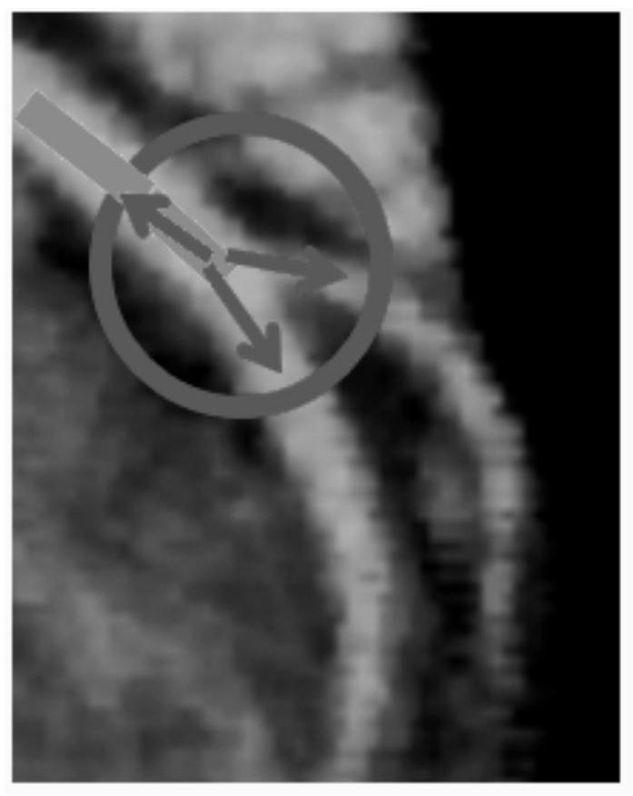 Cardiac artery blood vessel segmentation method and device, equipment and medium