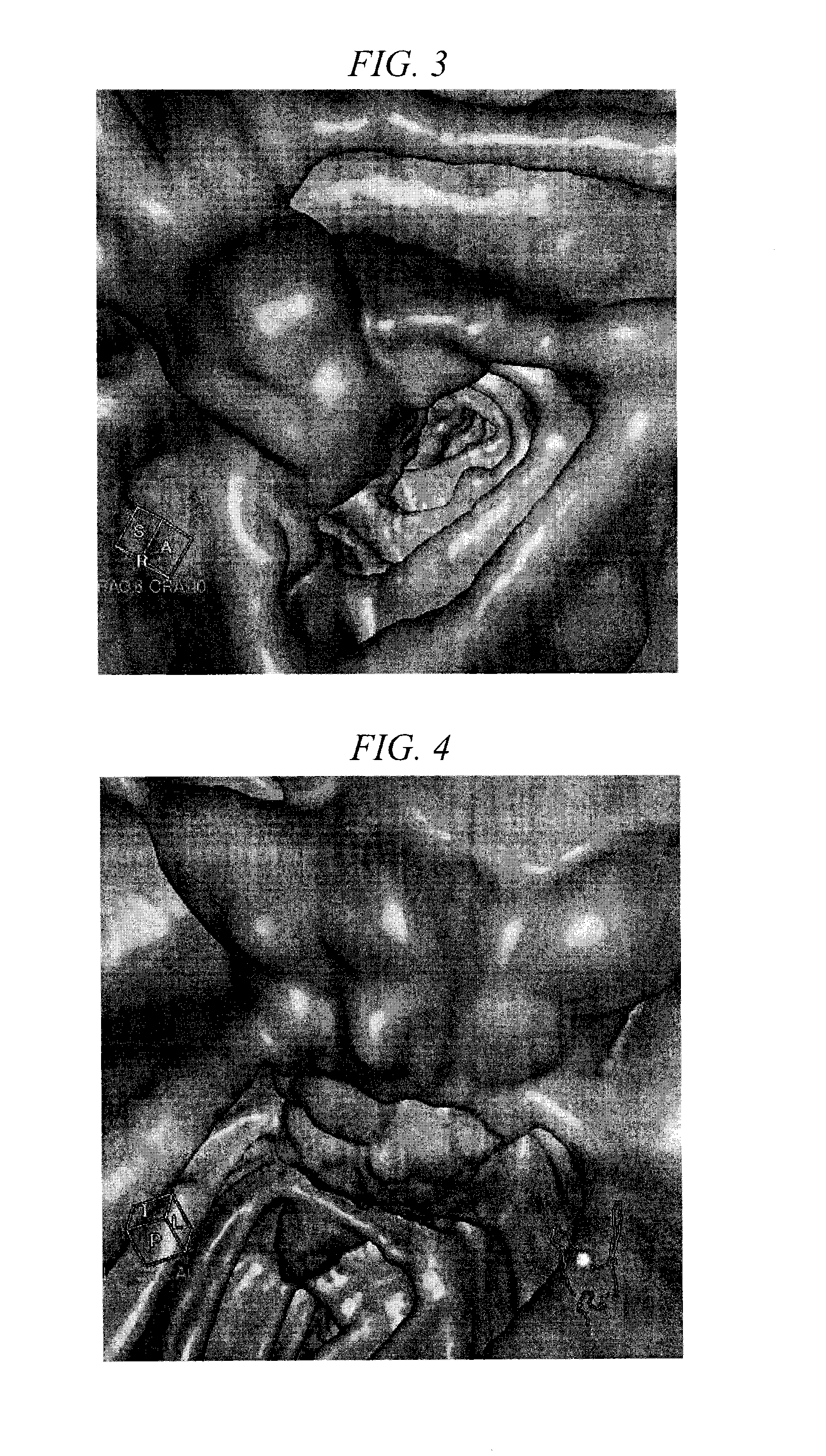 Liquid preparation for oral administration used for ct colonography and composition for gastrointestinal radiography