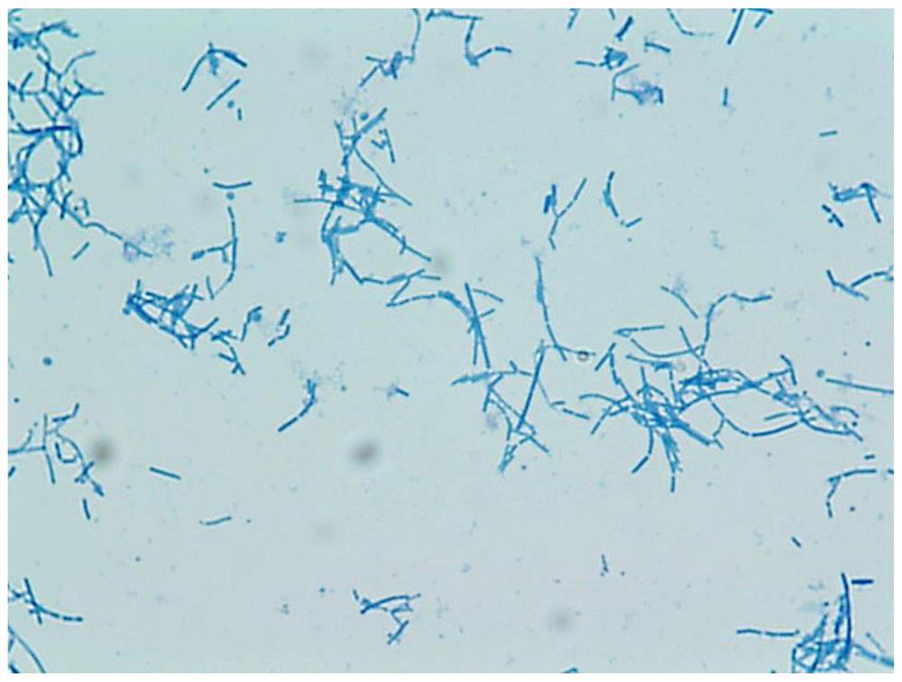 Lactobacillus helveticus strain and application thereof