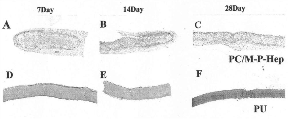 Preparation method of double-layer artificial small-diameter blood vessel with modified inner layer