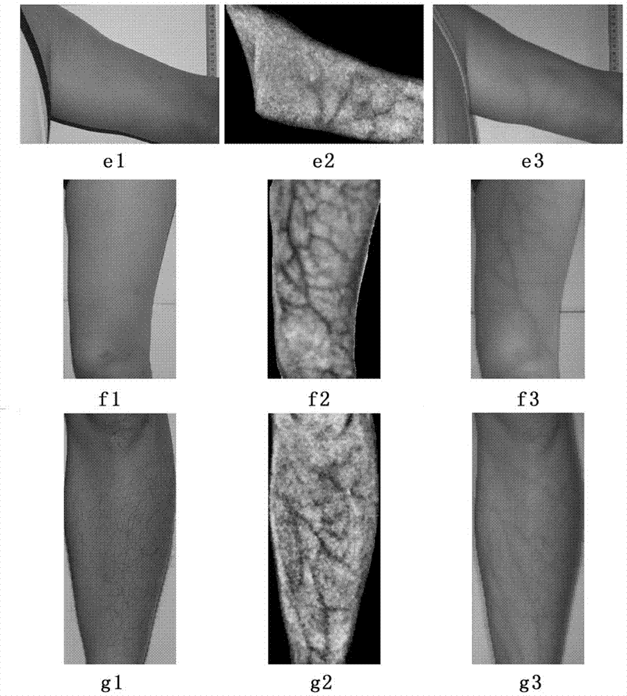 Visible light skin image vein imaging method