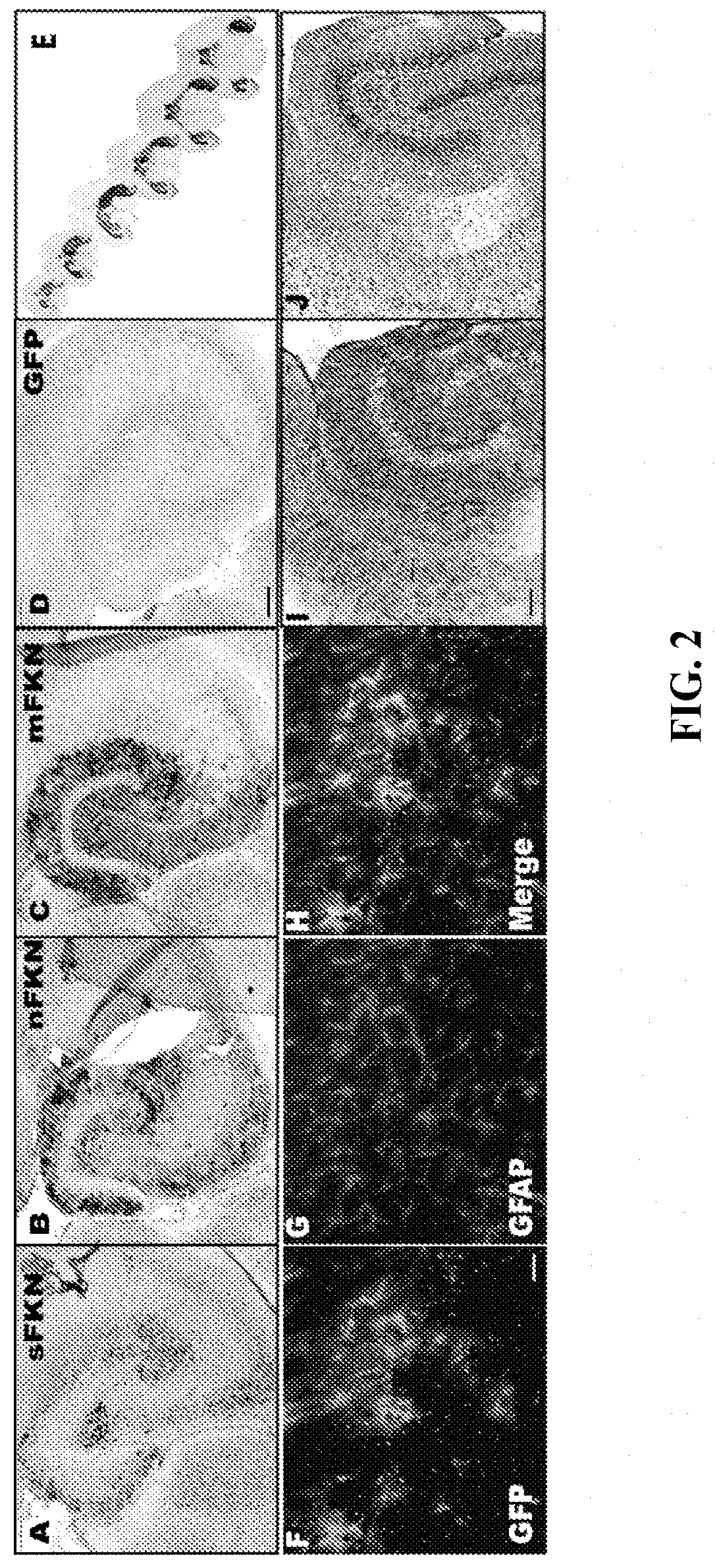 Recombinant adeno-associated virus-mediated expression of fractalkine for treatment of neuroinflammatory and neurodegenerative diseases