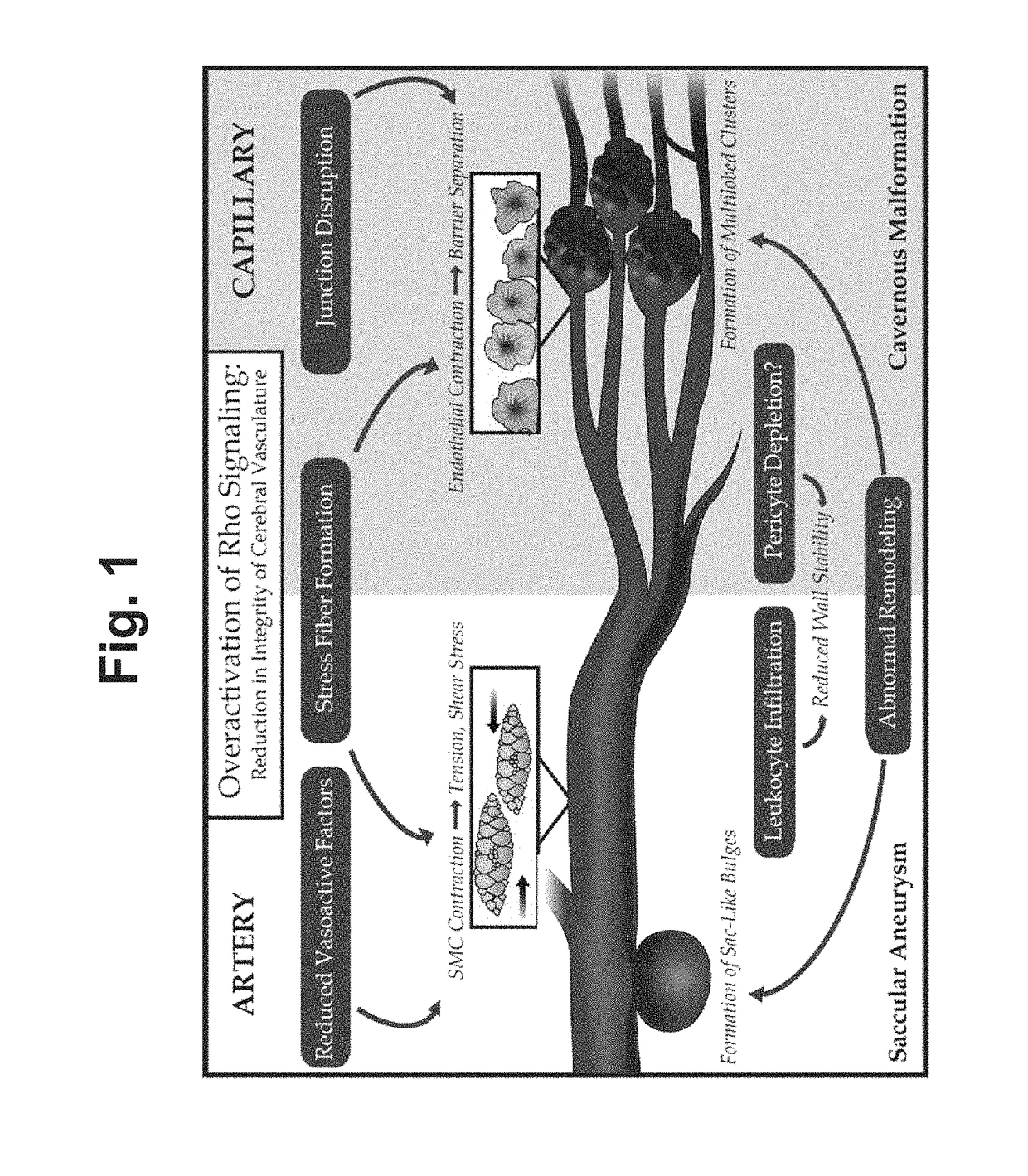 Treatment of cerebral cavernous malformations and cerebral aneurysms with rho kinase inhibitors