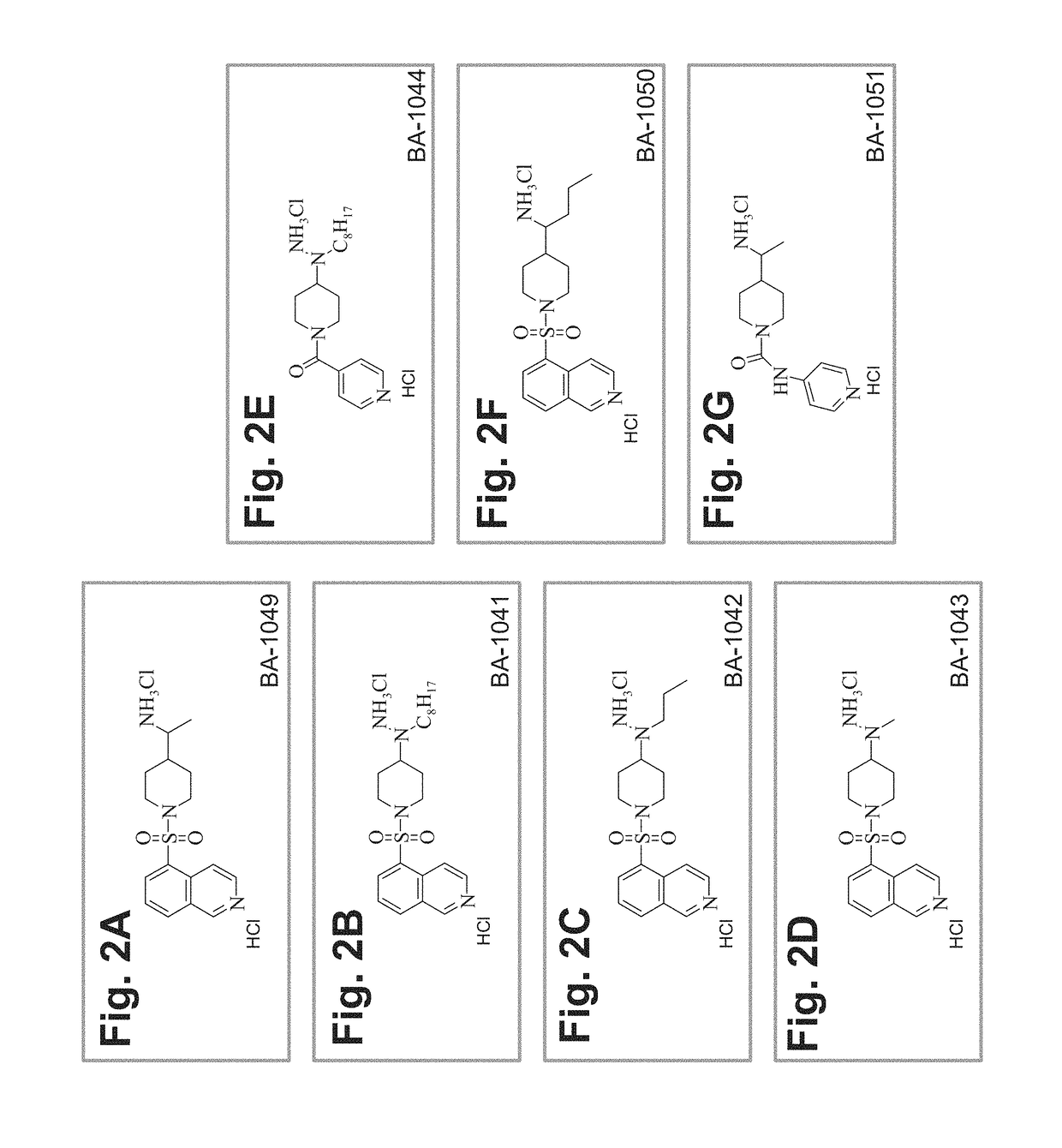 Treatment of cerebral cavernous malformations and cerebral aneurysms with rho kinase inhibitors