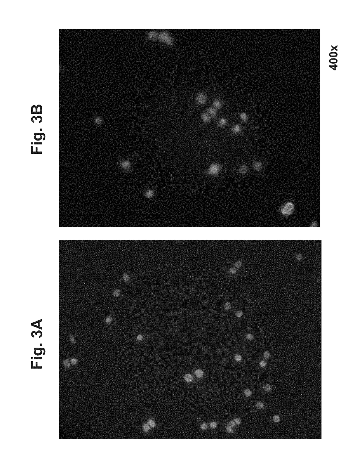 Treatment of cerebral cavernous malformations and cerebral aneurysms with rho kinase inhibitors