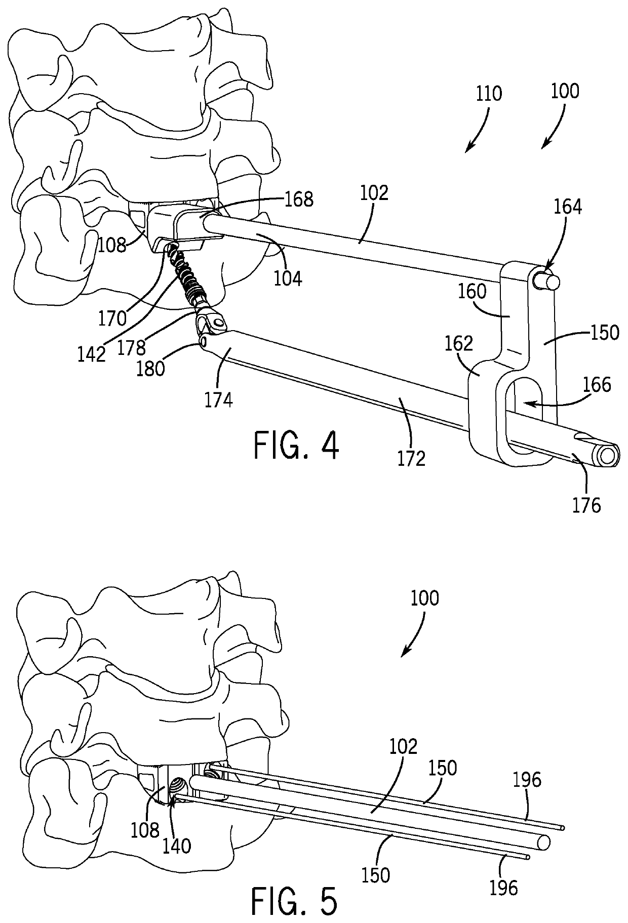 Spinal joint implant delivery device and system