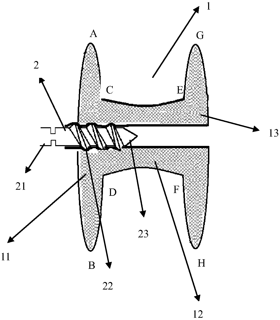 Artificial chordae tendineae fixing assembly capable of being adjusted several times and intervention method thereof