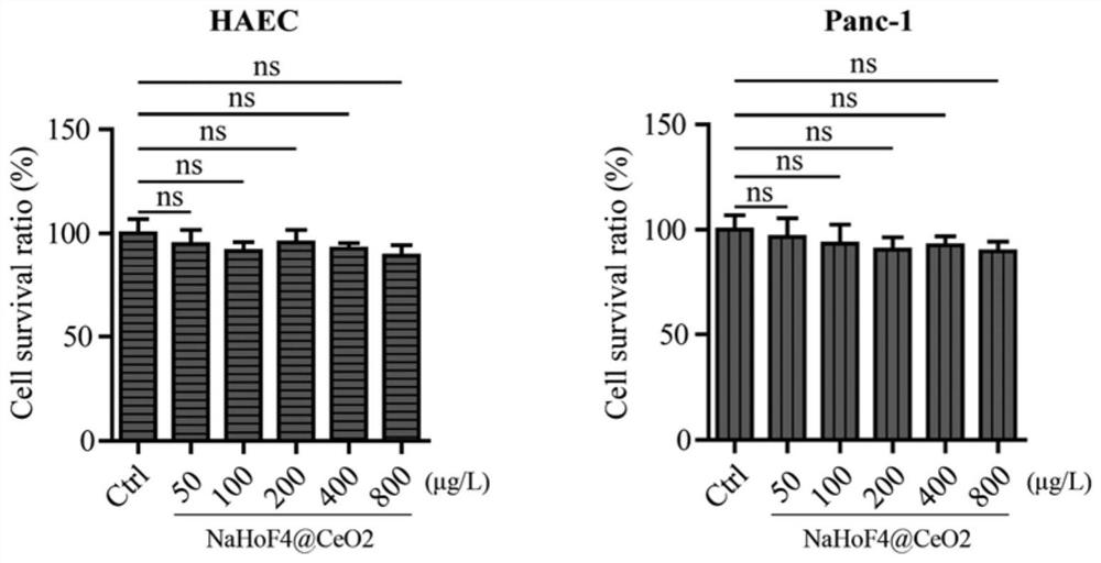 A novel rare earth nanometer dual-mode imaging agent and its preparation method and application