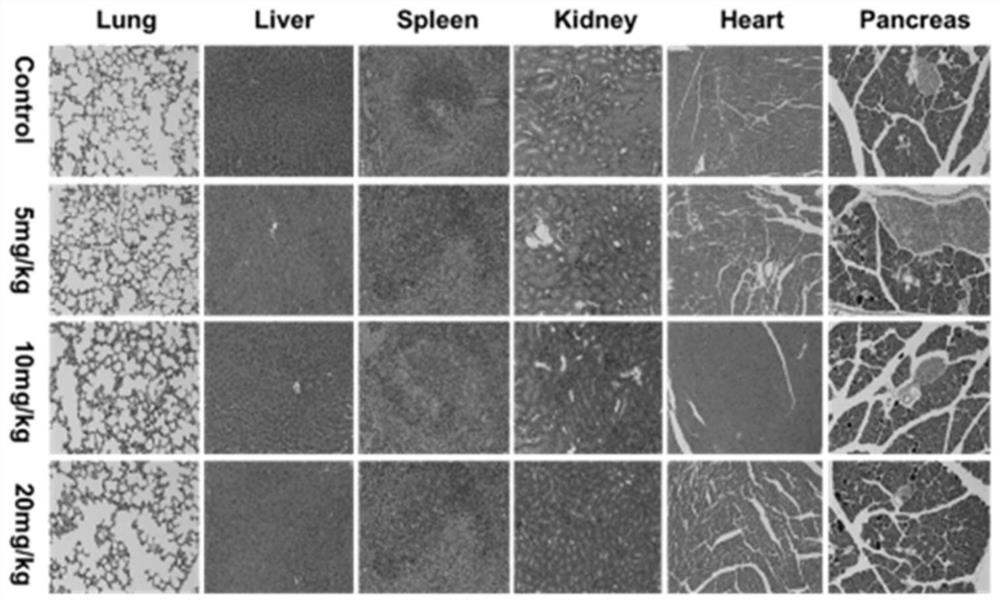 A novel rare earth nanometer dual-mode imaging agent and its preparation method and application