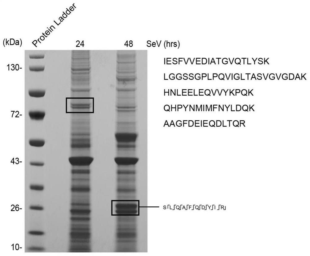 Application of reagent for detecting expression level of RIG-I-Shart in preparation of products for tumor diagnosis and/or prognosis