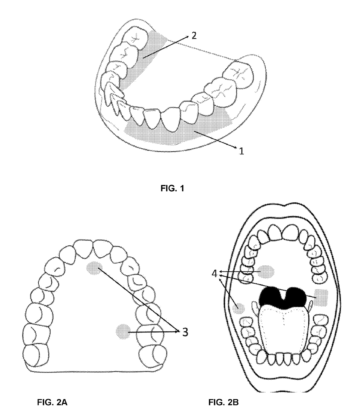 Filmogenic compositions for topical anaesthetic bioadhesives - tabs, for controlled release of active principles and topical anaesthetic bioadhesives