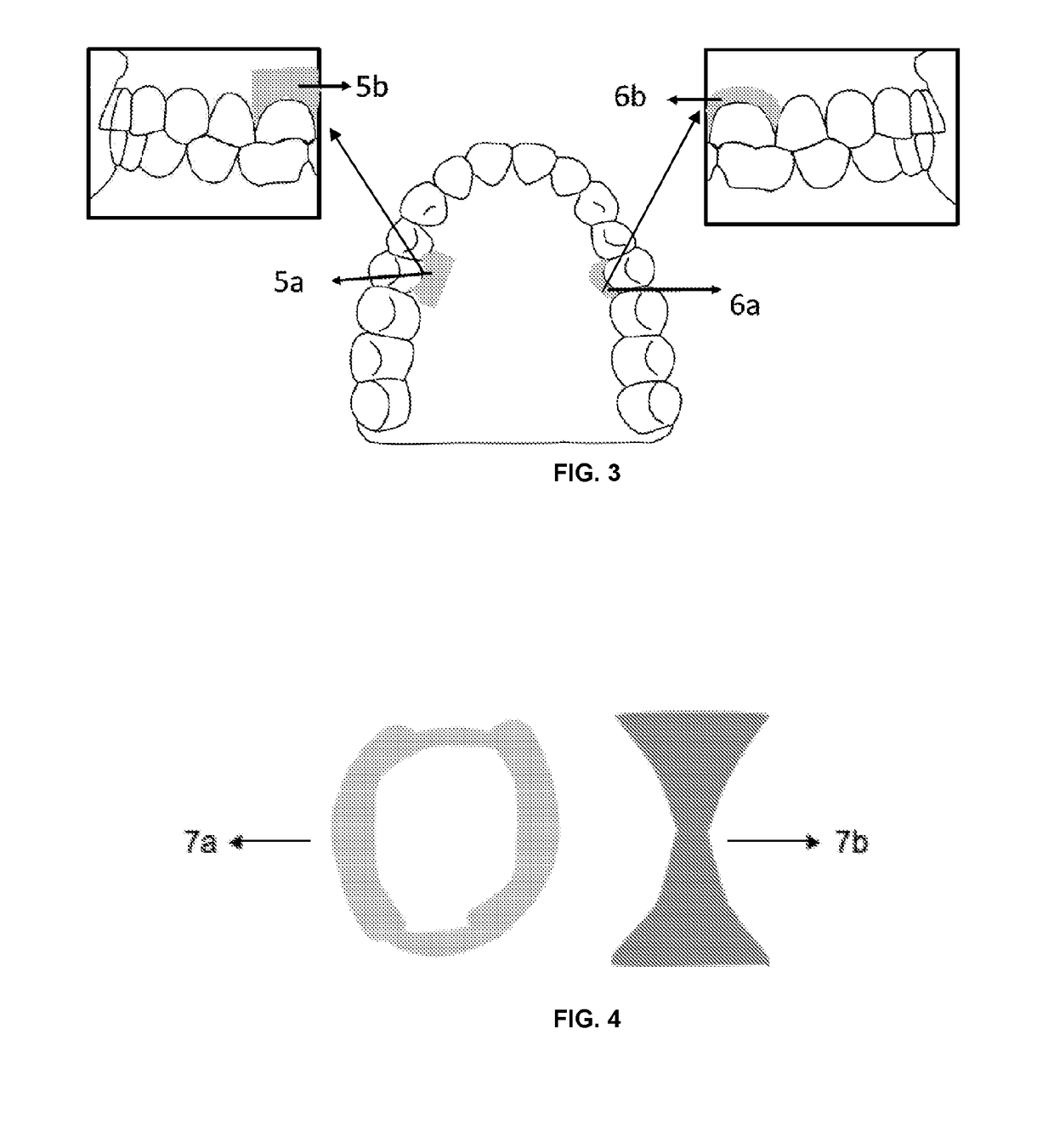 Filmogenic compositions for topical anaesthetic bioadhesives - tabs, for controlled release of active principles and topical anaesthetic bioadhesives