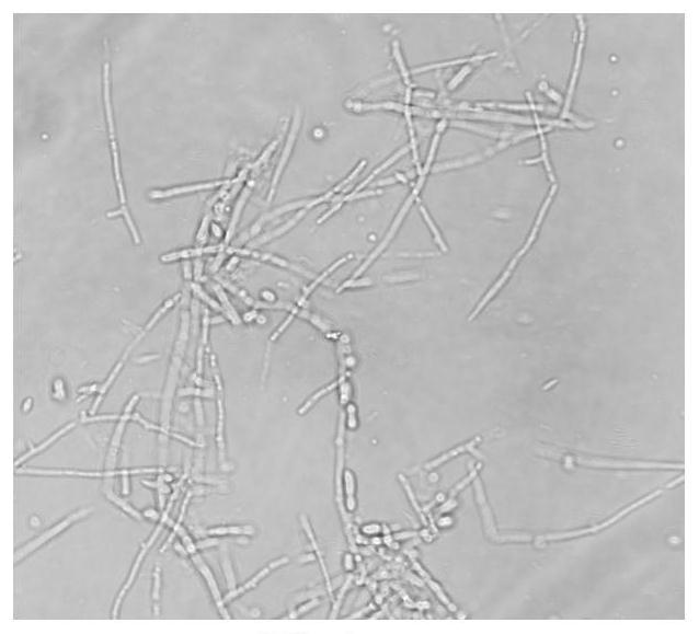 Root-knot nematode biocontrol fungus acremonium implicatum protoplast preparation and regeneration method