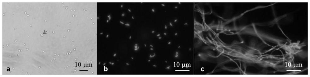 Root-knot nematode biocontrol fungus acremonium implicatum protoplast preparation and regeneration method