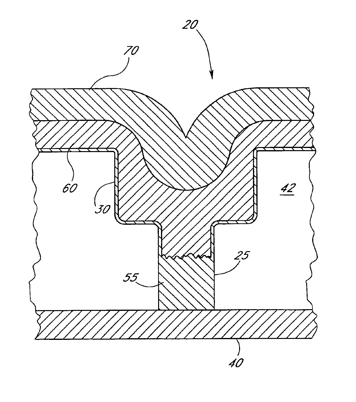 Method of forming a dual damascene interconnect by selective metal deposition
