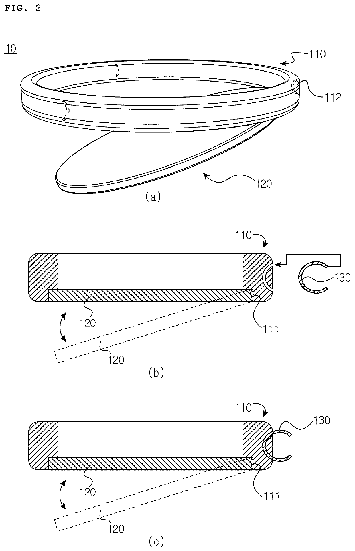 Anti-reflux valve for preventing gastroesophageal reflux disease