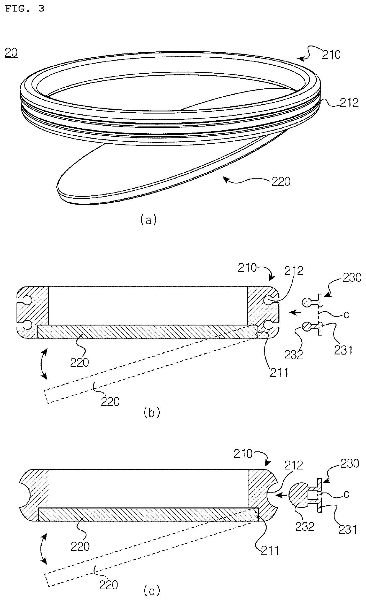 Anti-reflux valve for preventing gastroesophageal reflux disease