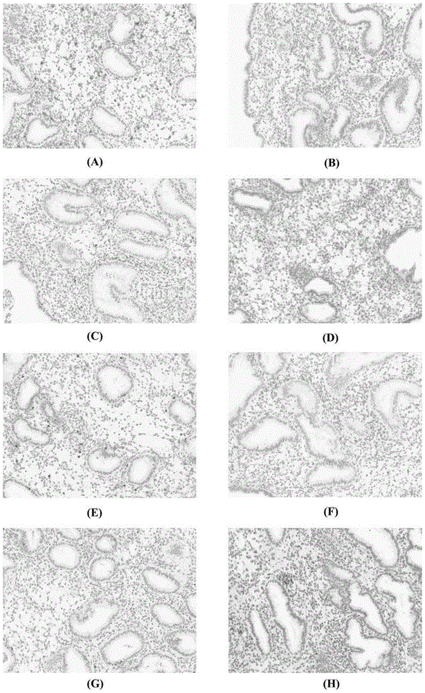 Kit for assessment of endometrial receptivity and use method thereof