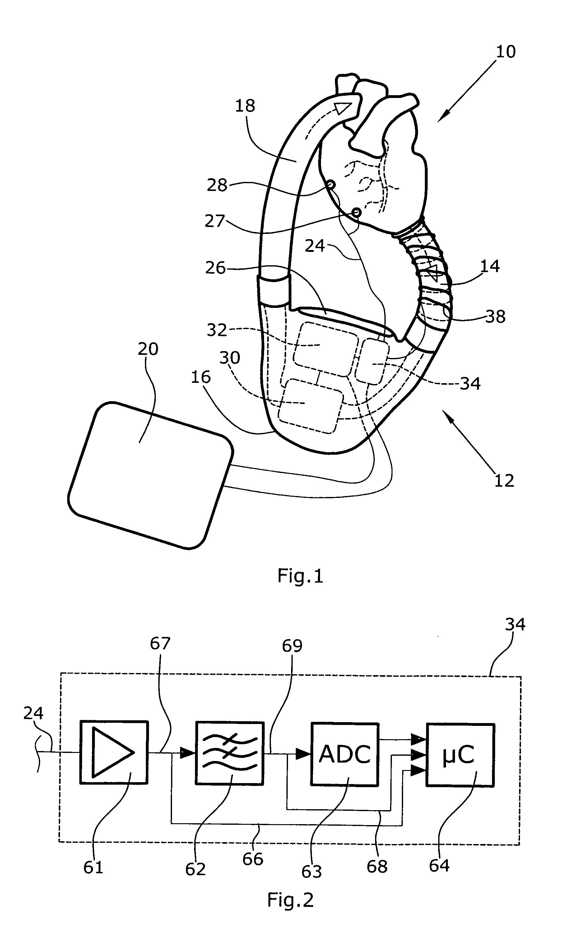 Artificial Heart