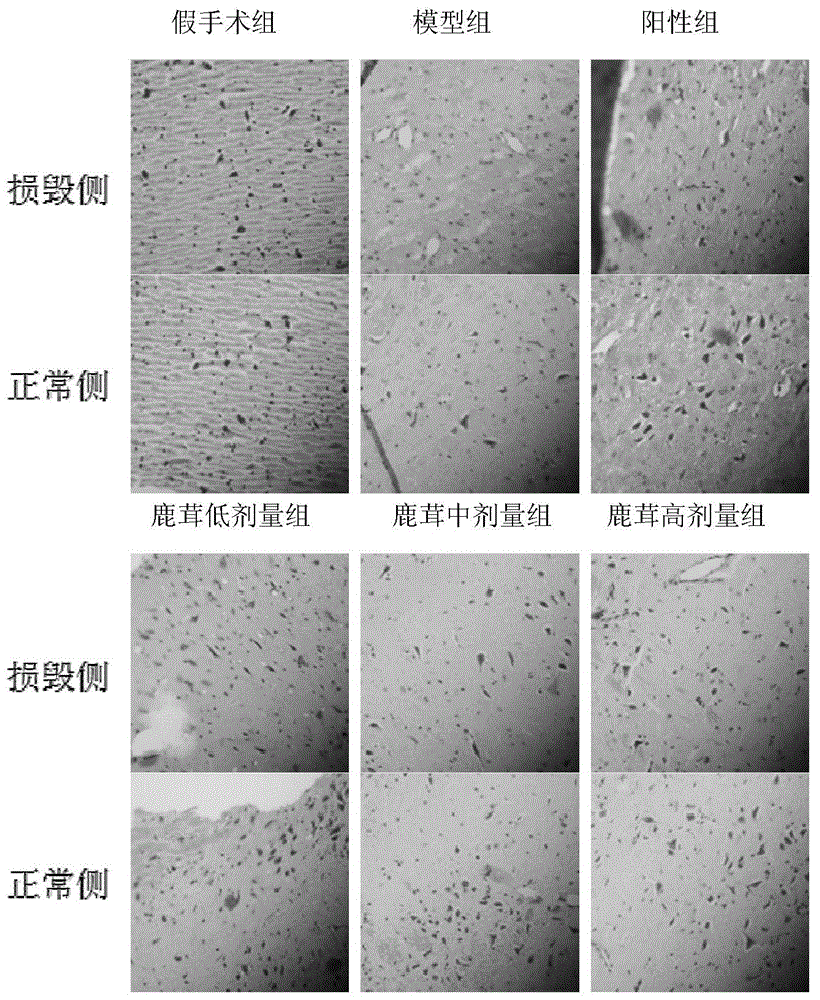 Application of pilose antler extract in preparation of products for preventing and/or treating Parkinson disease