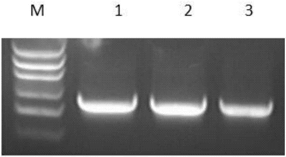 Method for screening MKL-1 protein interaction proteins via yeast two-hybrid screening
