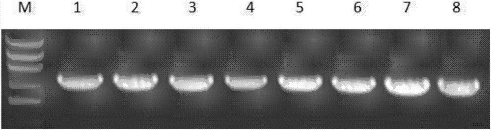Method for screening MKL-1 protein interaction proteins via yeast two-hybrid screening