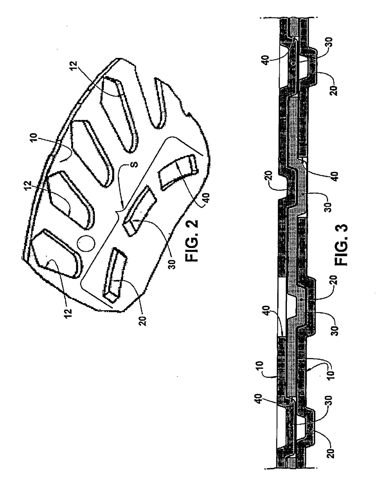 Process For The Formation Of A Stack Of Superposed Metallic Laminations