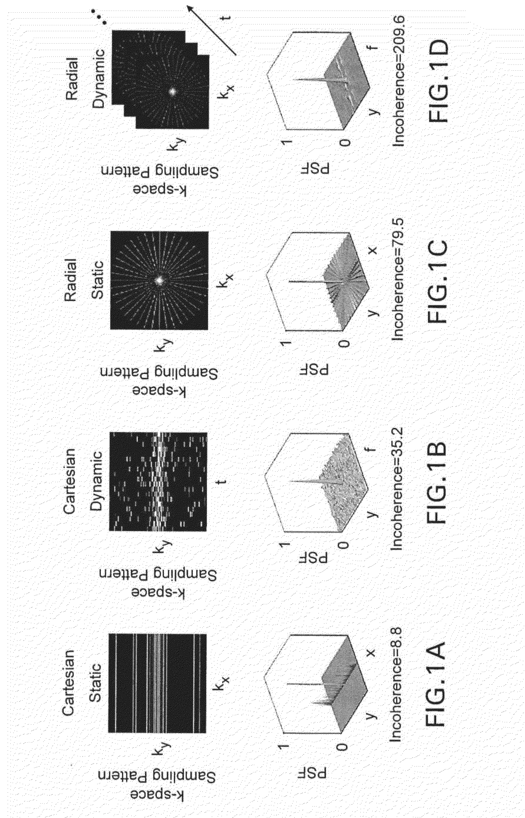 System, method and computer-accessible medium for highly-accelerated dynamic magnetic resonance imaging using golden-angle radial sampling and compressed sensing