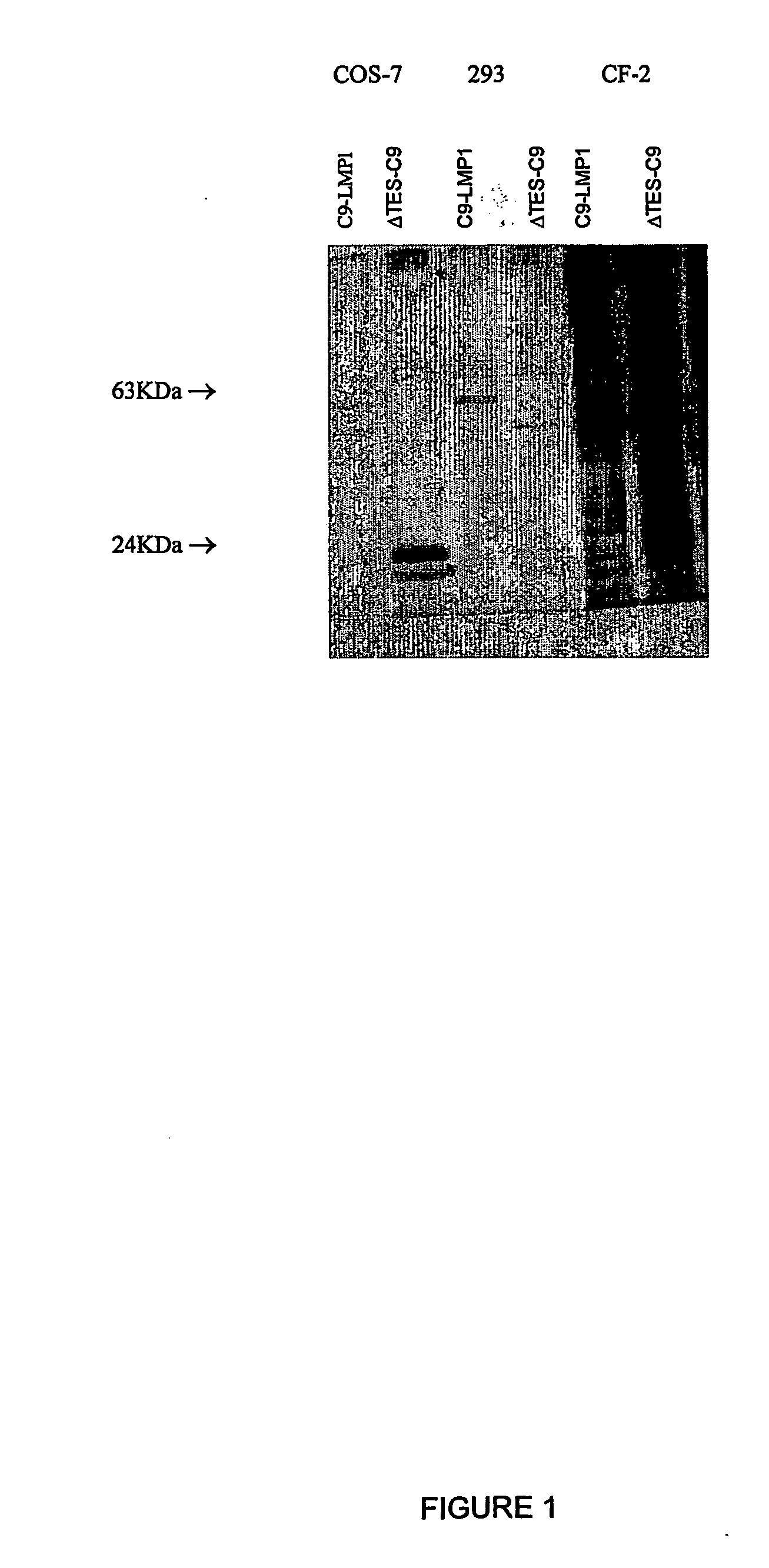 Antibody to latent membrane proteins and uses thereof