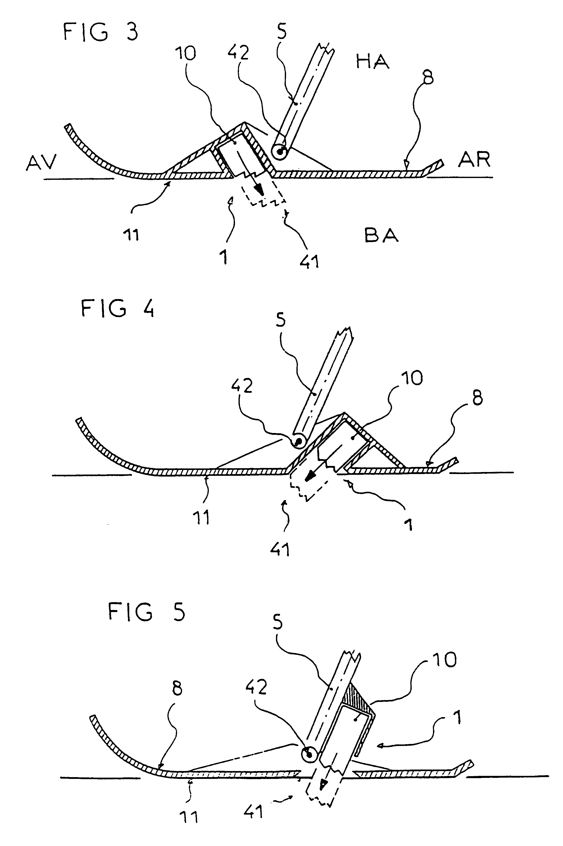Braking device for a motorized snow vehicle