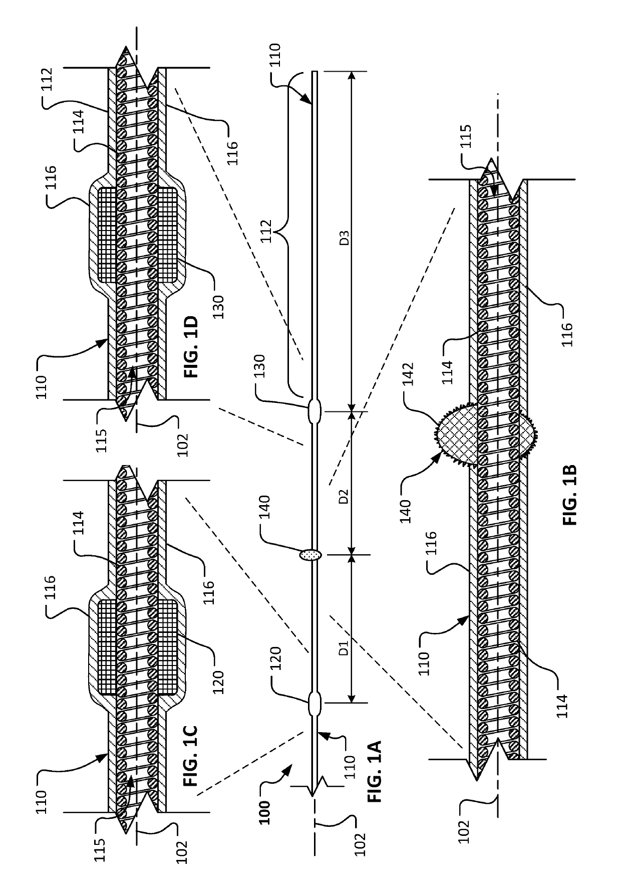 Atherectomy devices and methods