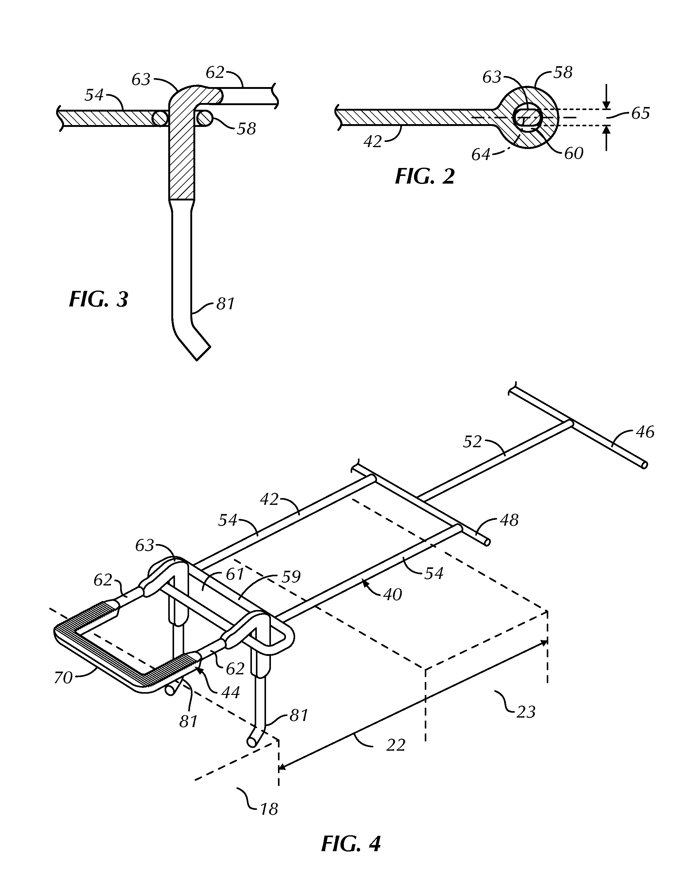 High-strength partially compressed low profile veneer tie and anchoring system utilizing the same
