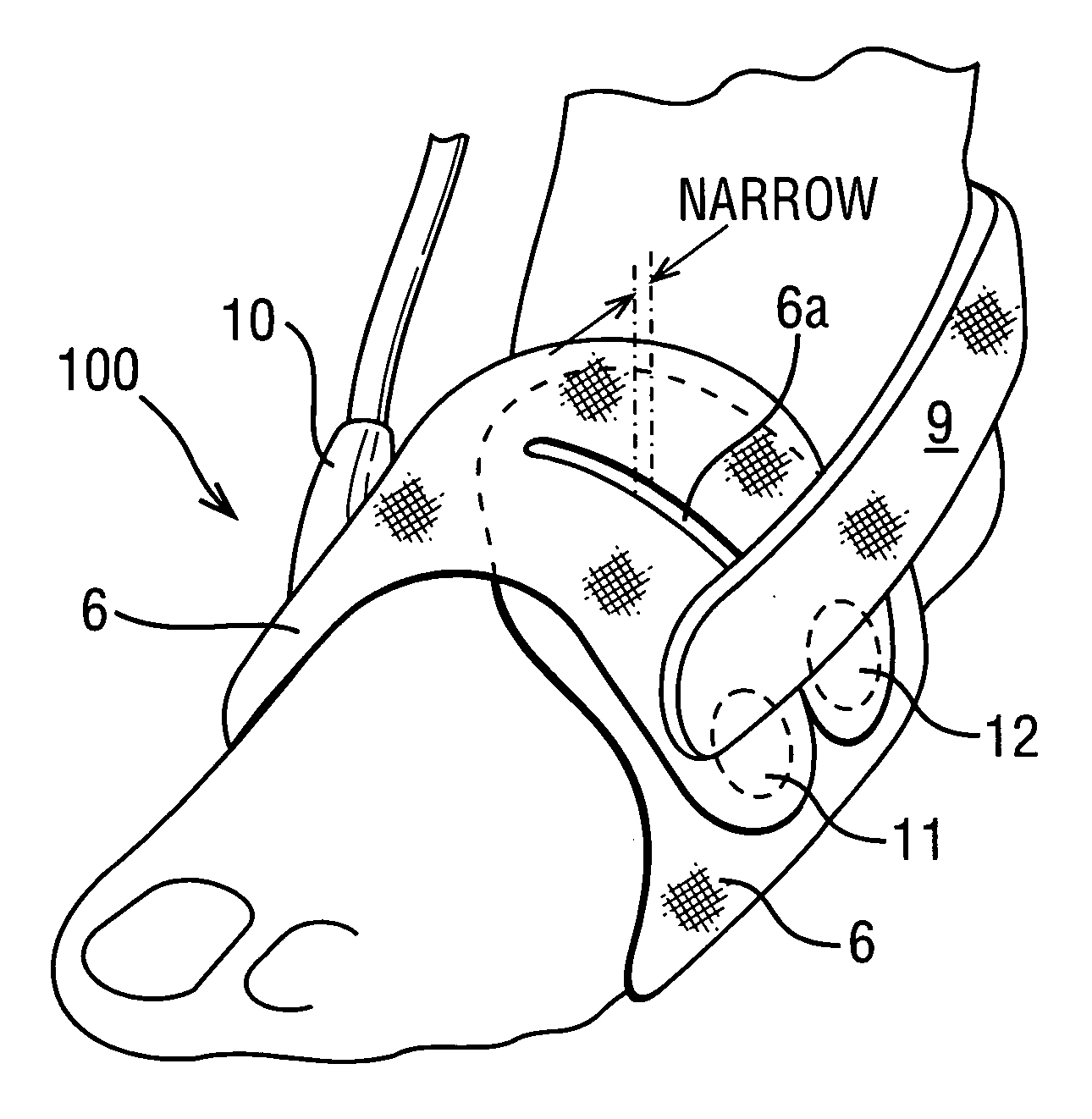 Garment for use in pump therapy for enhancing venous and arterial blood flow