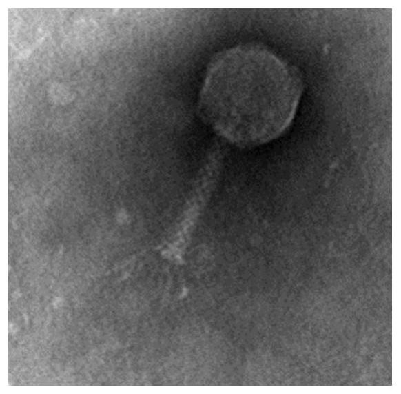 T4SS targeted bacteriophage vBEcoMX4 and application thereof