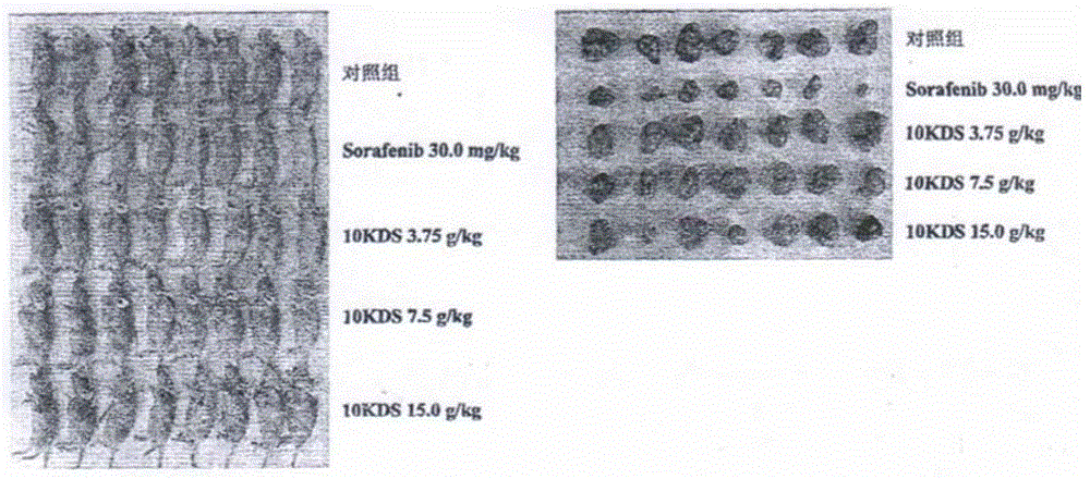Chinese medicinal composition for treatment of liver cancer and application thereof