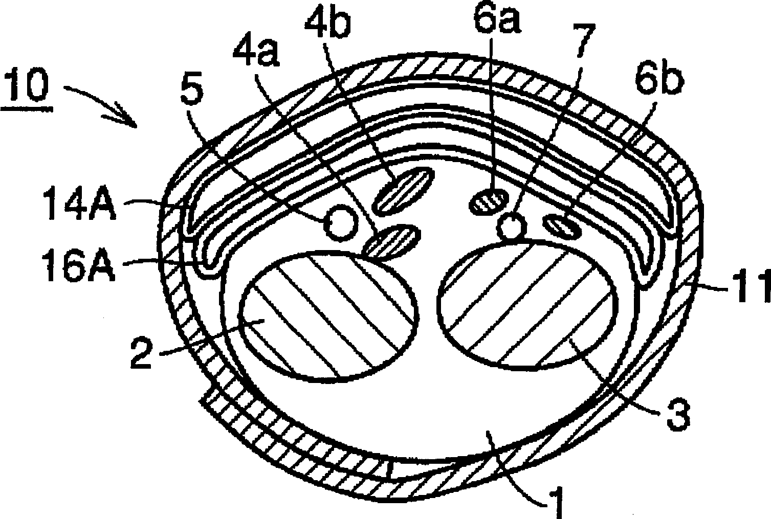 Wrist ring of wrist-type tonometer