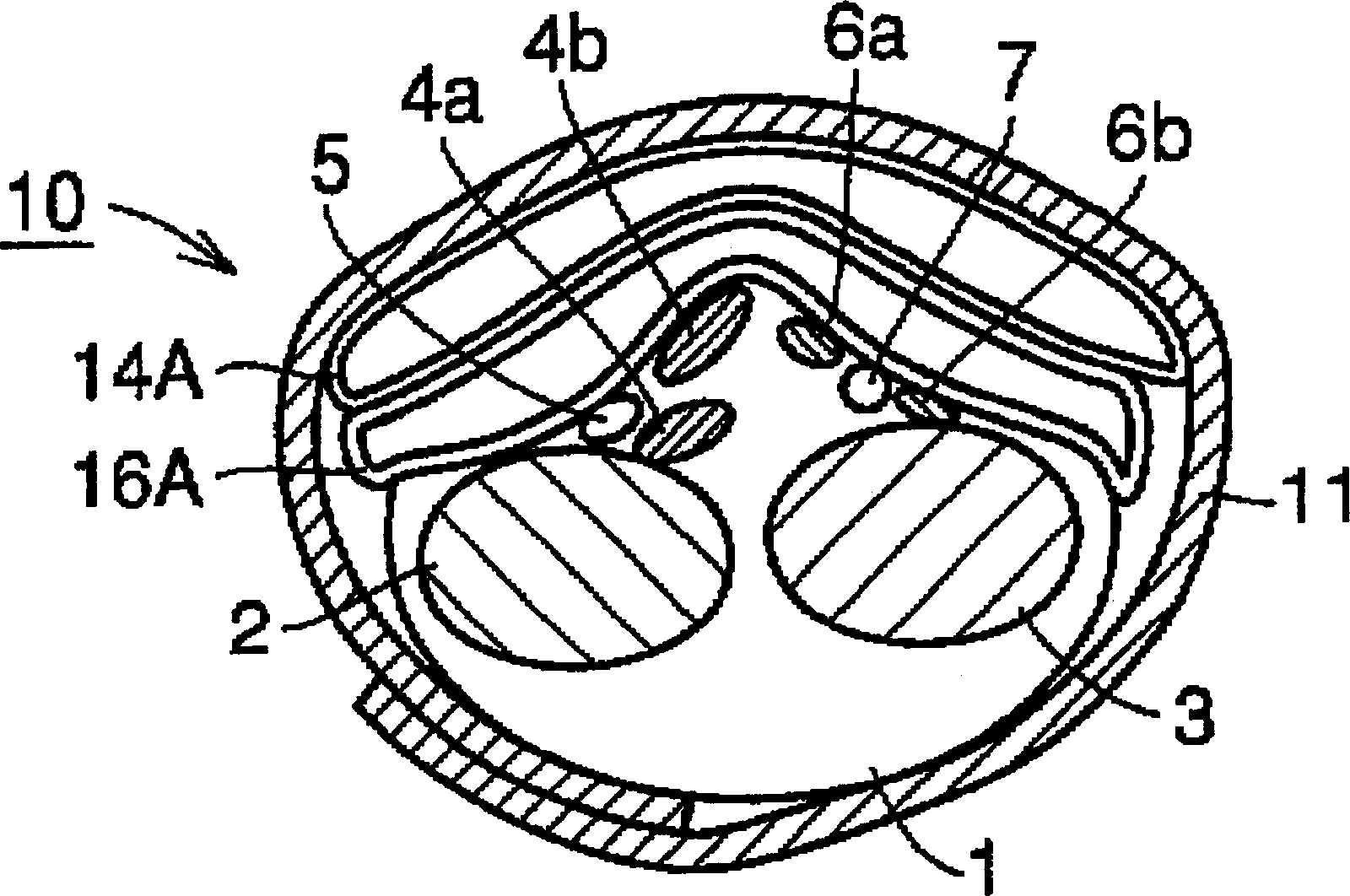 Wrist ring of wrist-type tonometer