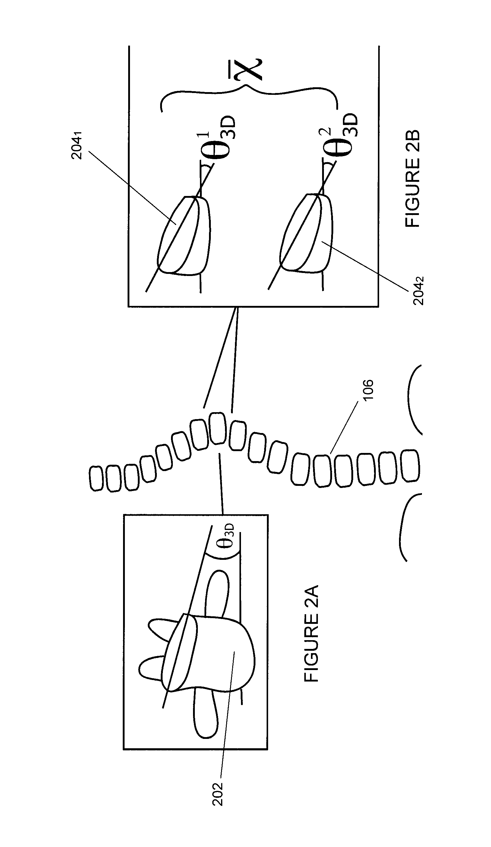 System and method for predicting scoliosis progression
