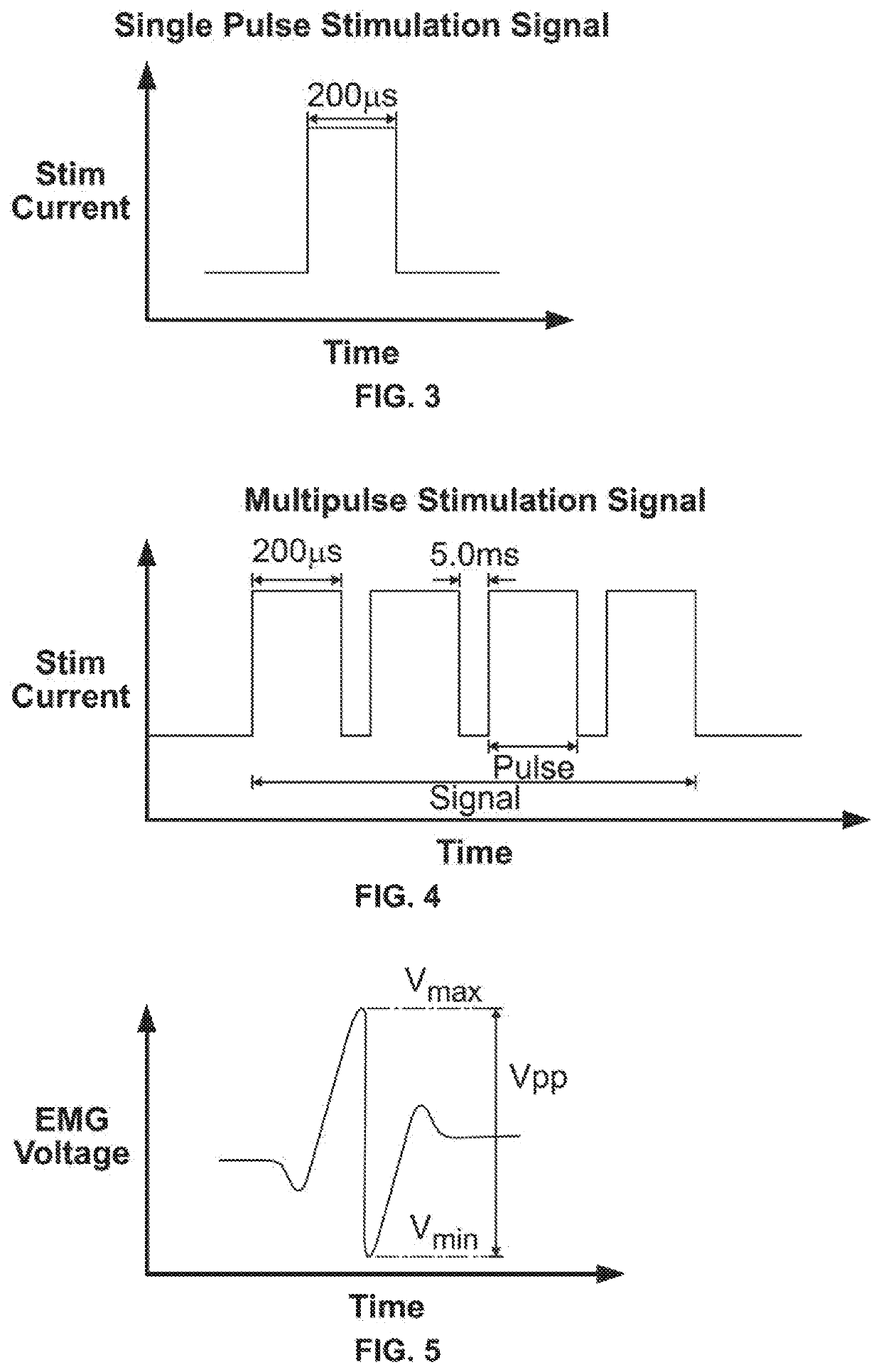 Systems and Methods for Performing Neurophysiologic Monitoring
