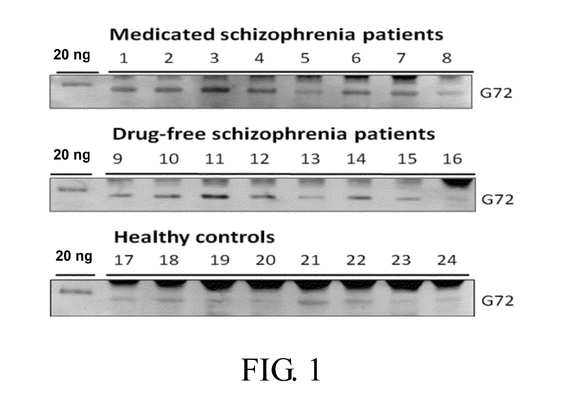 Compositions and methods for diagnosis of schizophrenia