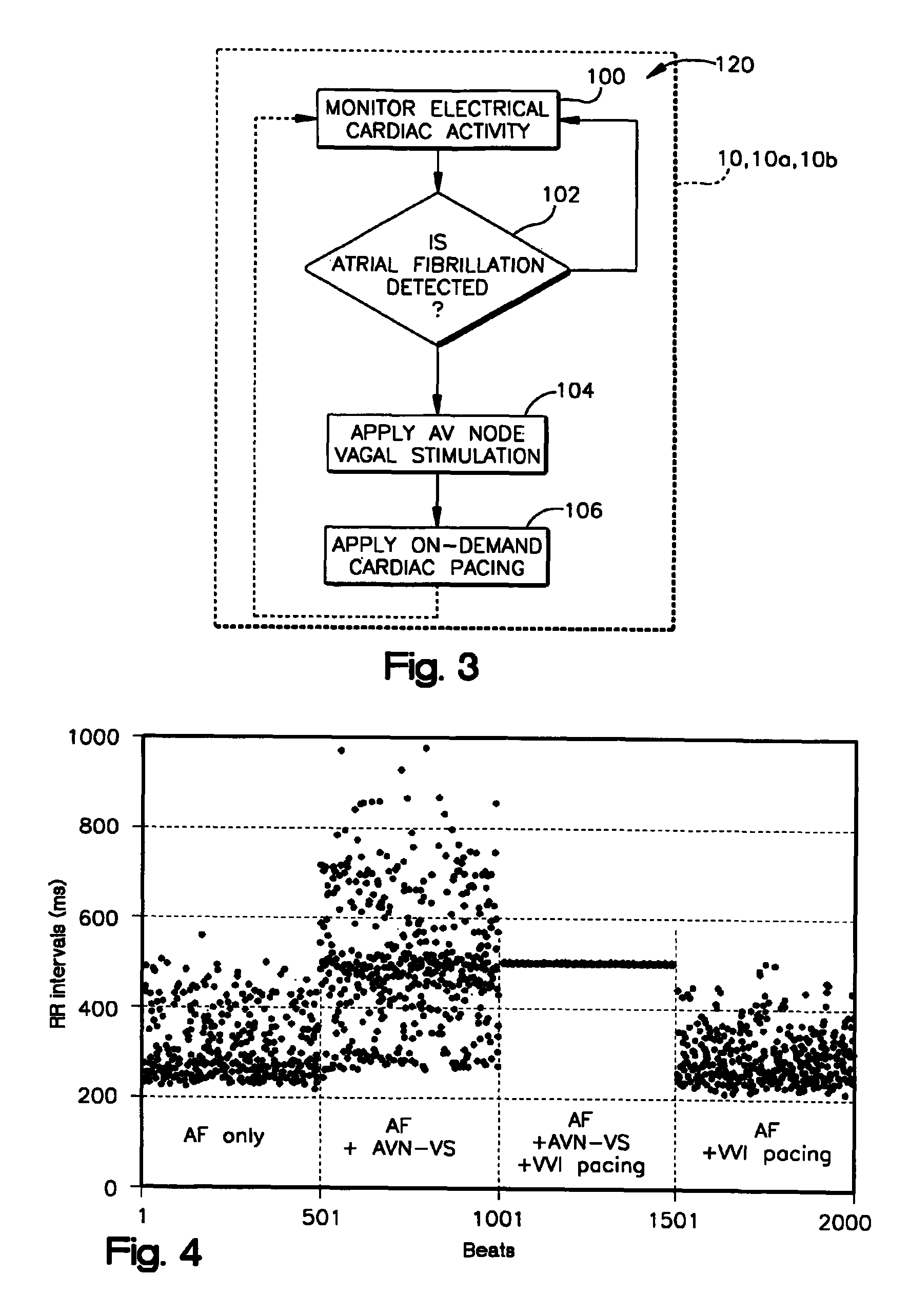 System and method for achieving regular slow ventricular rhythm in response to atrial fibrillation