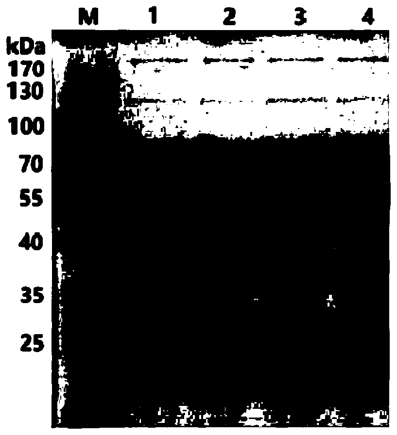 Egg yolk antibody composition and application thereof in preparation of product for preventing and treating gastrointestinal diseases